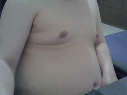 al2m024720